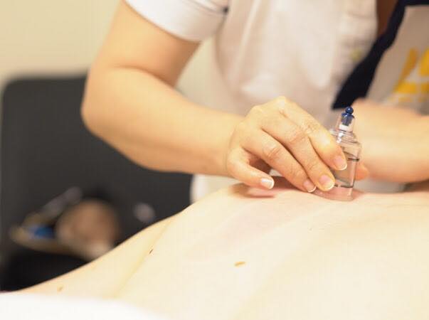 Cupping Treatment At Le Spa Massage Academy