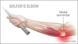 Golfer Elbow