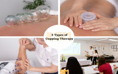 03. MYOFASCIAL & TRADITIONAL FLAME CUPPING THERAPIES COURSE