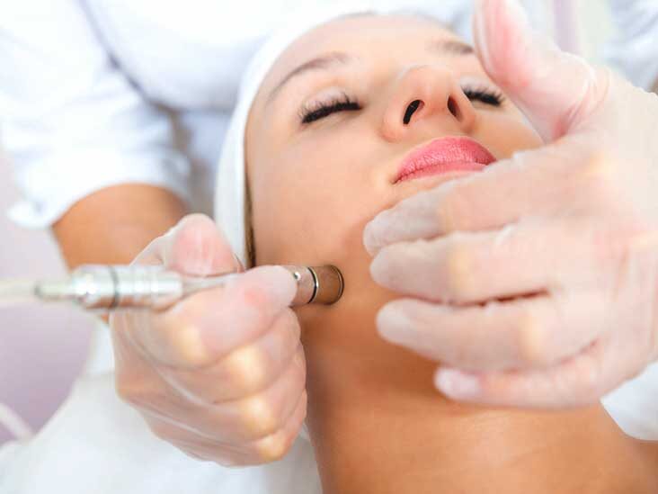 MICRODERMABRASION